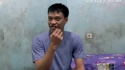 Penyebab Mata Kurnia Meiga Buta dikarenakan Alkohol, Hal ini Penjelasannya