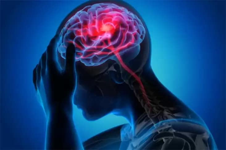 Terapi Cermin Efektif Tingkatkan Fungsi Motorik Pasien Stroke
